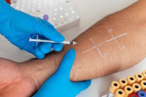 Allergy Testing in San Antonio, Autin, Schertz, Kileen, New Braunfels, Texas