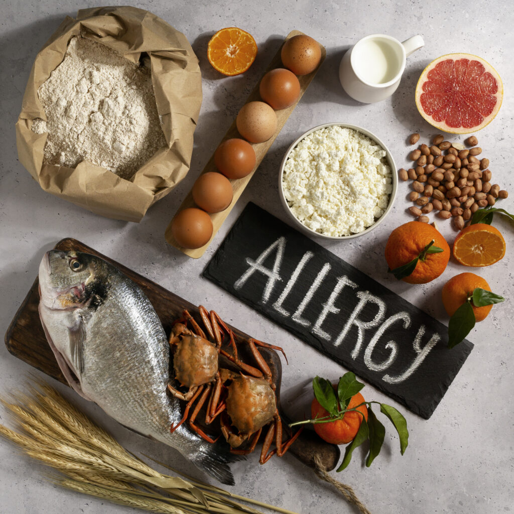 Food Allergies