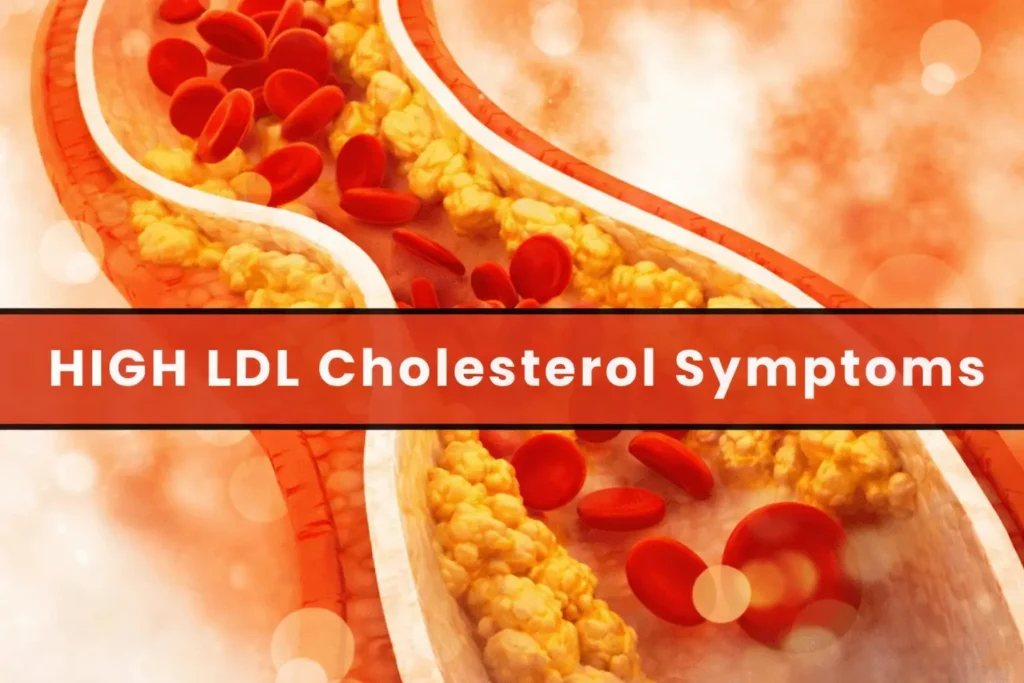 High HDL Cholesterol Symptoms